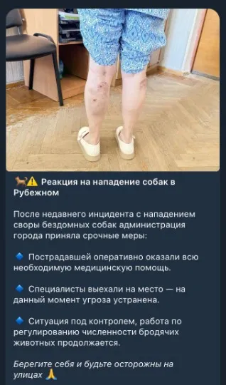 У Рубіжному жінку покусали собаки